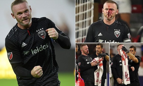 Rooney Scores First Goal for DC United before Leaving Pitch with Gruesome Injury