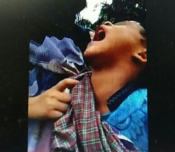Seorang anak yang teriak minta alat vitalnya dikembalikan seperti semula (foto. tangkapan layar Twitter)