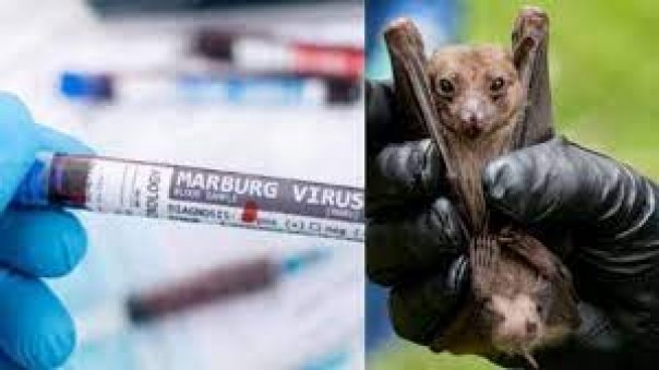 Ngeri! Anak yang terinfeksi virus Marburg meninggal di Ghana
