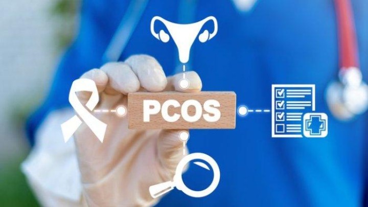 Apakah PCOS yang Sudah Sembuh Dapat Kambuh Kembali? Begini Penjelasan dr. Ronny Adrian, Sp.OG