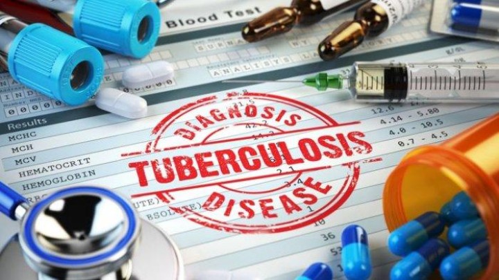 Waspada, Kasus TBC Terbanyak Dialami pada Kelompok Usia 45 sampai 54 Tahun